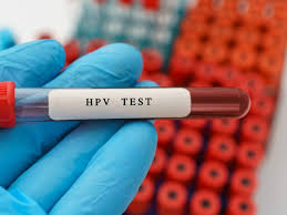 HPV 테스트